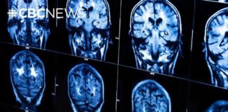 New guidelines urge doctors to treat heart and brain health
