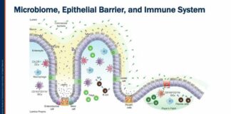 Current Understandings of the Role of the Gut in Autoimmune