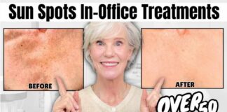 I Reversed SUN DAMAGE & CREPEY SKIN on My Almost 60