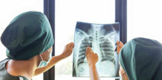 Two medical professionals examining an x-ray of a chest