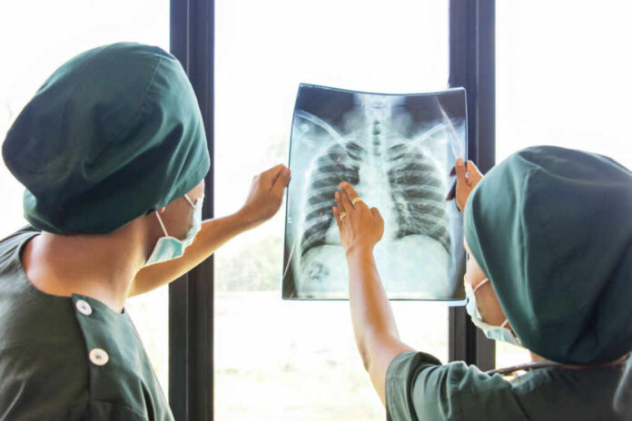 shutterstock_1513679480 Two medical professionals examining an x-ray of a chest