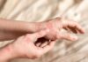 Blackcurrant seed oil for prevention of atopic dermatitis Close-up of a person's hands showing skin irritation and redness
