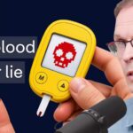 High Glucose, Brain Shrink — Alarming Link Insulin doctor: You will not live! The shocking link between blood sugar and brain health