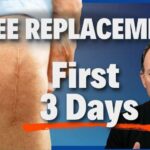 New Knee Replacement, Same Pain The First Days After Knee Replacement – What Most Patients Don't Expect