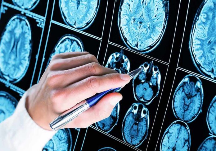 shutterstock_1176078337 Hand with pen pointing at brain MRI scans