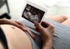 Pregnant person holding an ultrasound photo over their belly